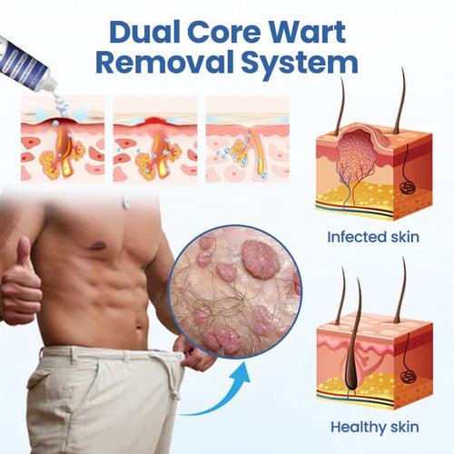 GentX WartRelief Cream