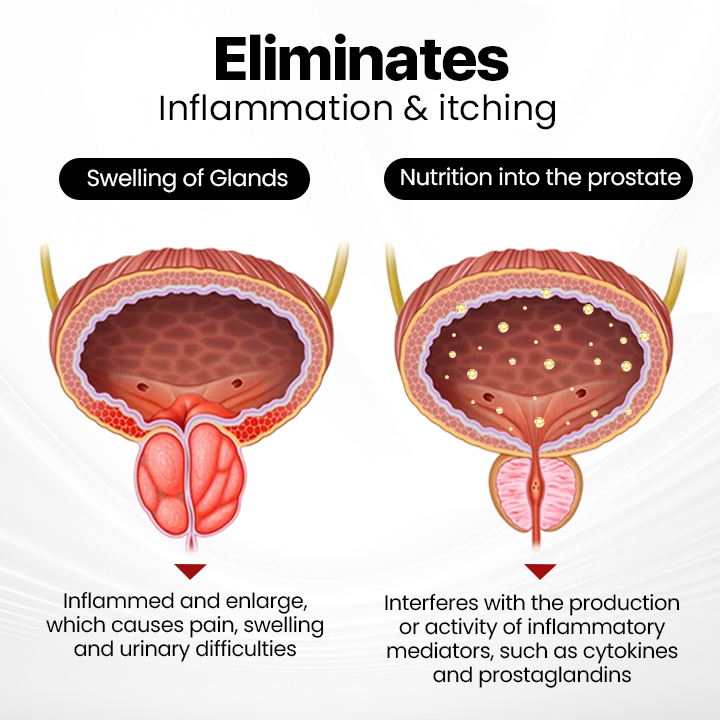 Last Day Discount: 87% OFF 🎇 NATRAVOR® ProstaAir Dual-Function Nasal Inhaler🌟