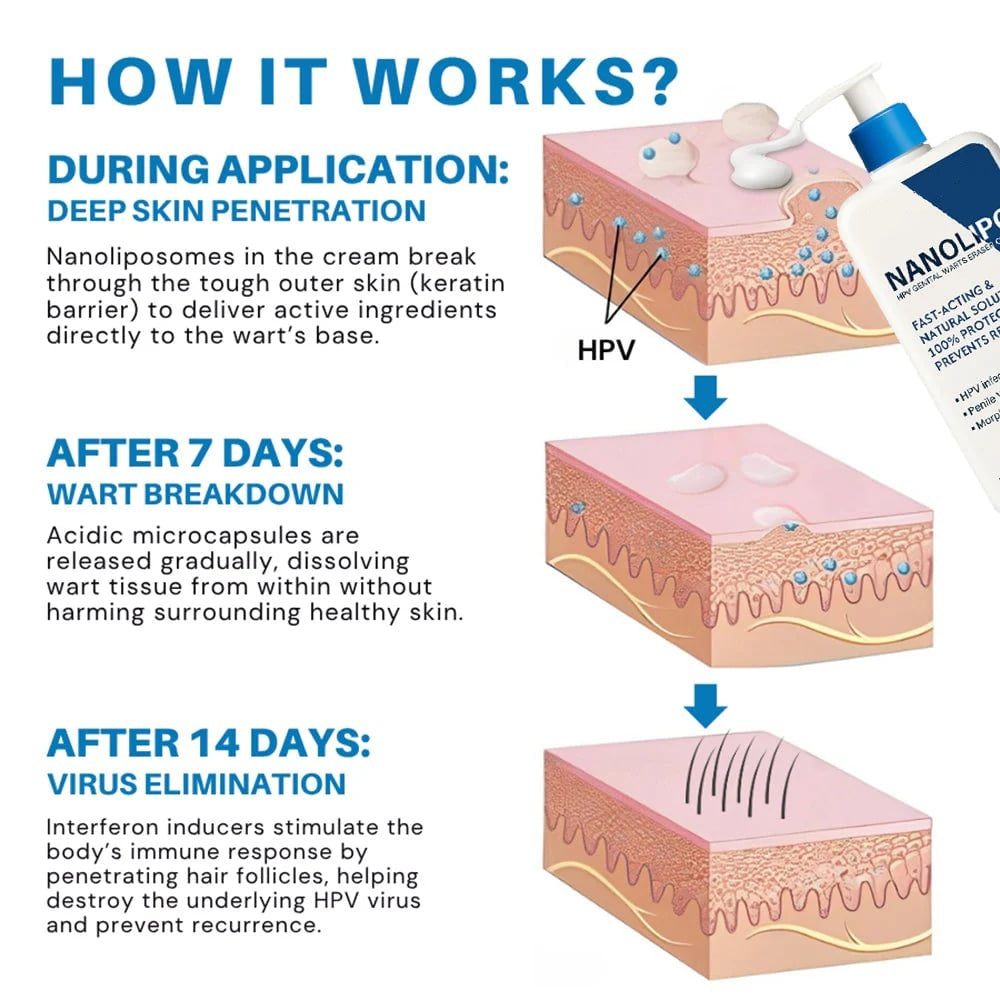 NanoLipo HPV Genital Warts Eraser Cream